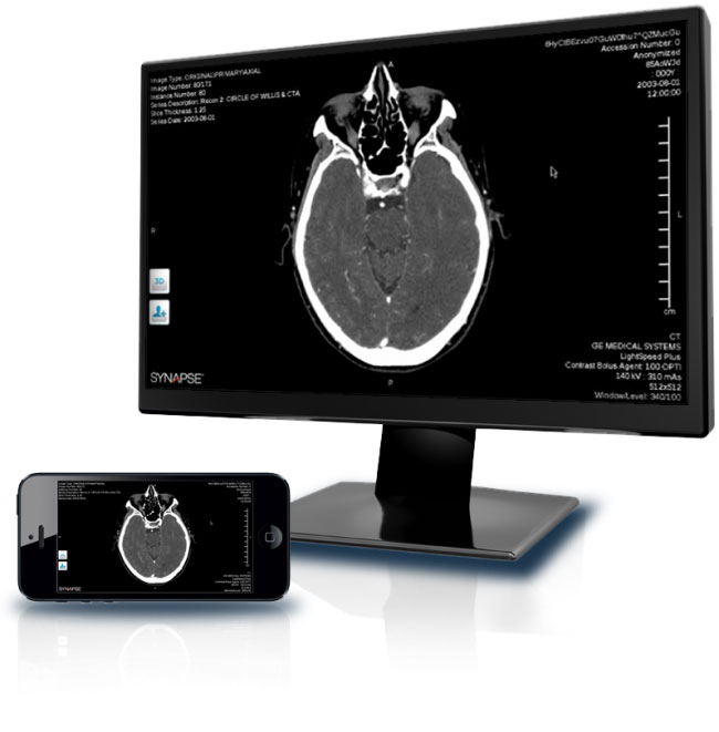 Sistema de PACS Synapse Fuji