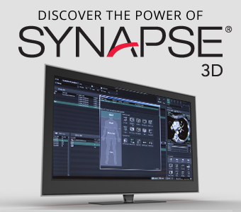 Sistema de Visualización Synapse 3D