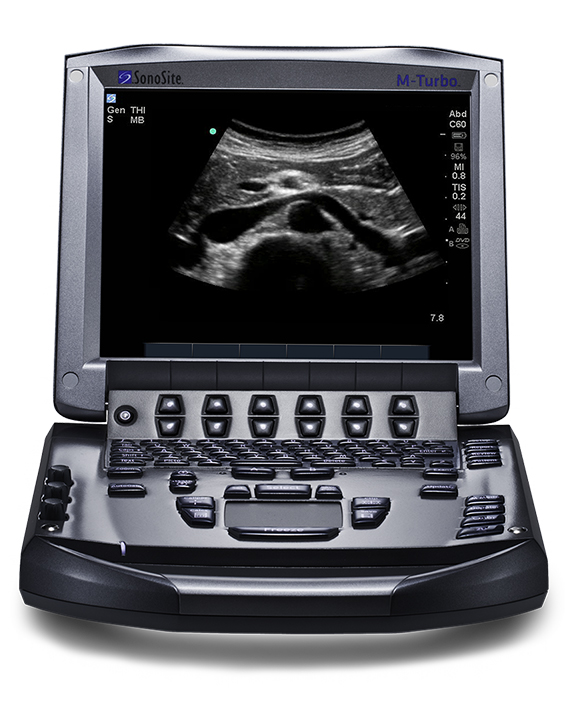 ultrasonidos sonosite m turbo