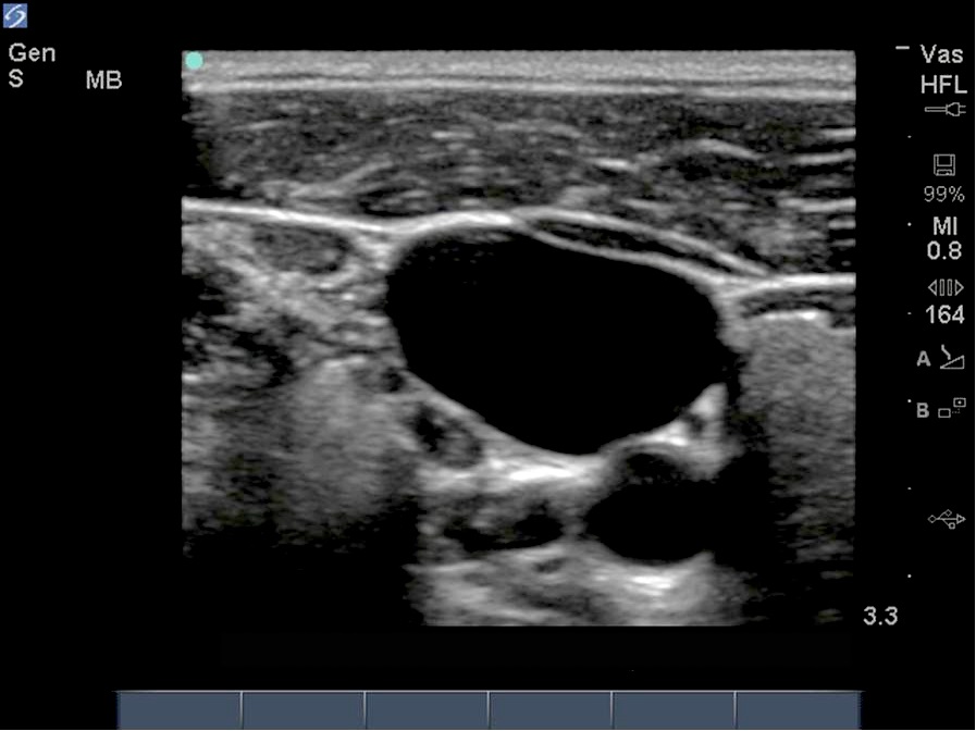 ultrasonidos medico imagen