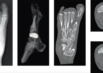venta de equipos médicos para radiología tac fracturas