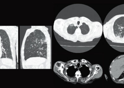 venta de equipos médicos para radiología