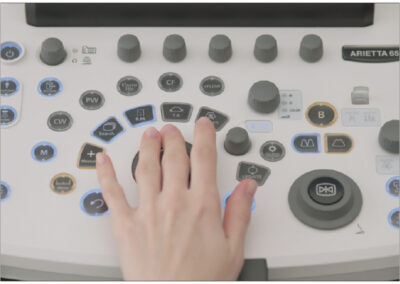 consola ultrasonidos arietta 65