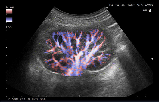 calidad imagen ultrasonido arietta 50