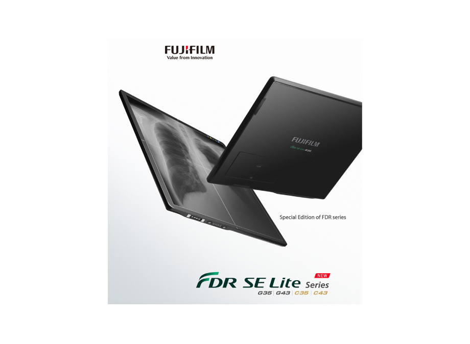 Detector Plano FDR SE Lite